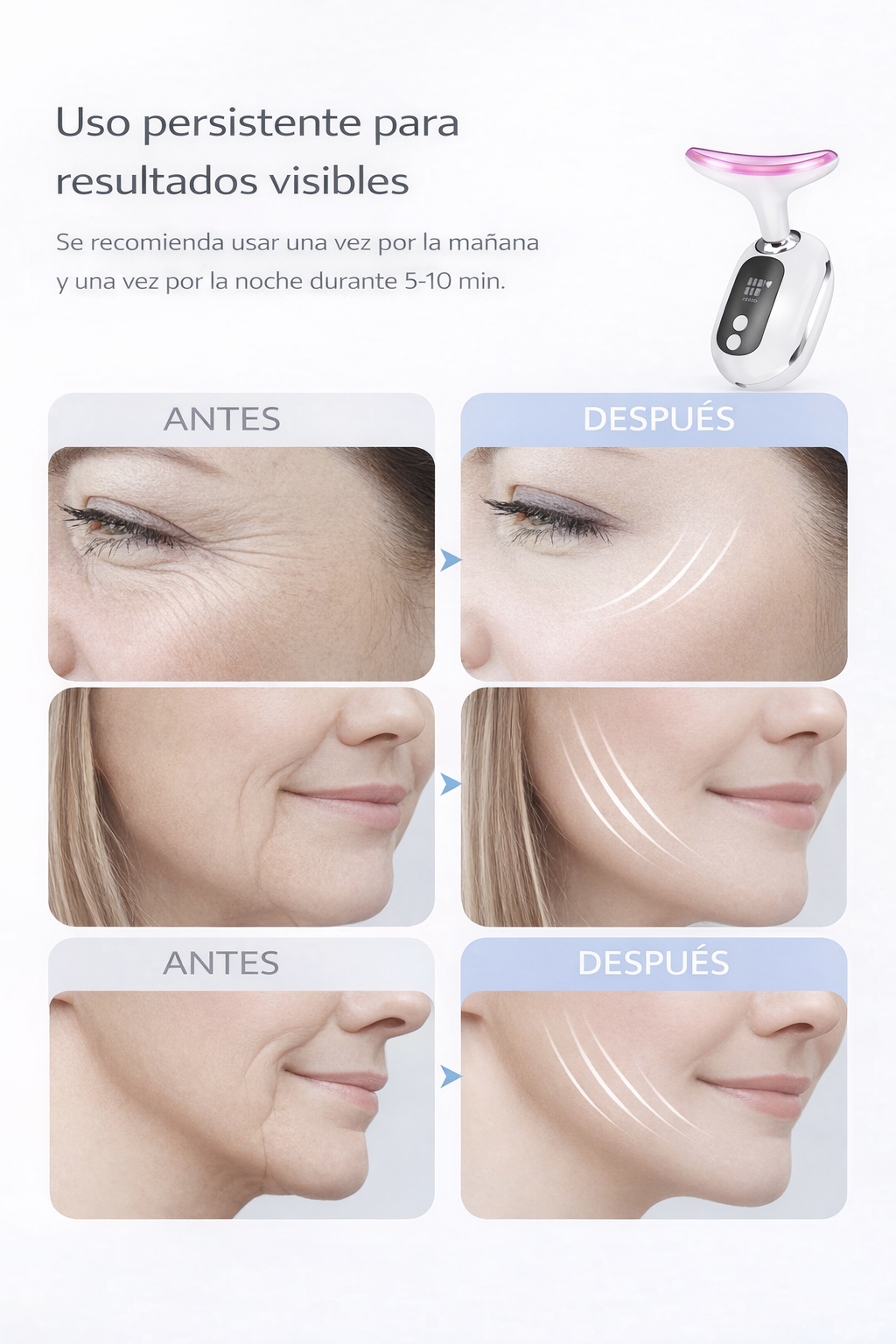 Masajeador Facial Wavi chic Rejuvenecedor  "El Secreto de Belleza de las Celebridades - ¡Para Ti!"